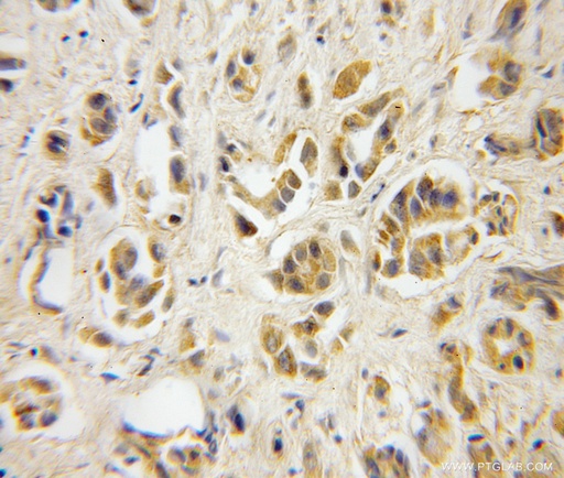 [12304-1-AP-150UL] TBCA Polyclonal antibody