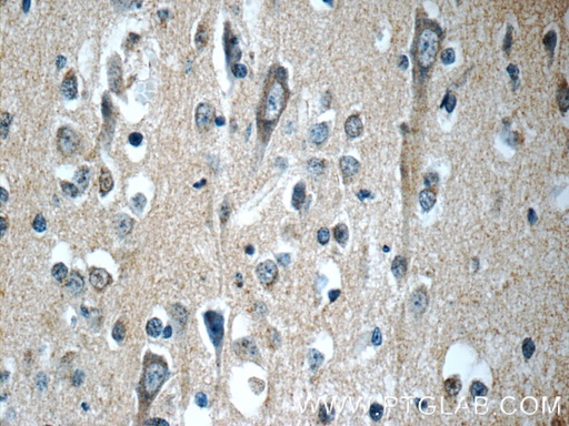 [12305-2-AP-20UL] APLP1 Polyclonal antibody