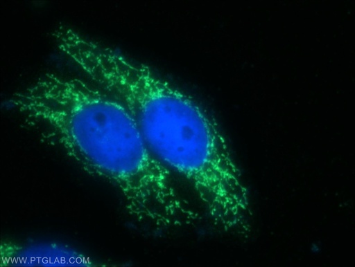 [12306-1-AP-150UL] ZFP36L1/2 Polyclonal antibody