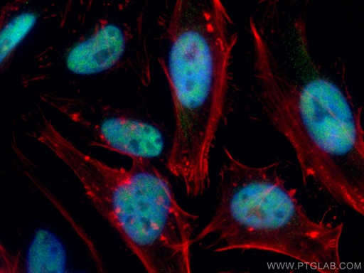 [12310-1-AP-150UL] HRPT2 Polyclonal antibody