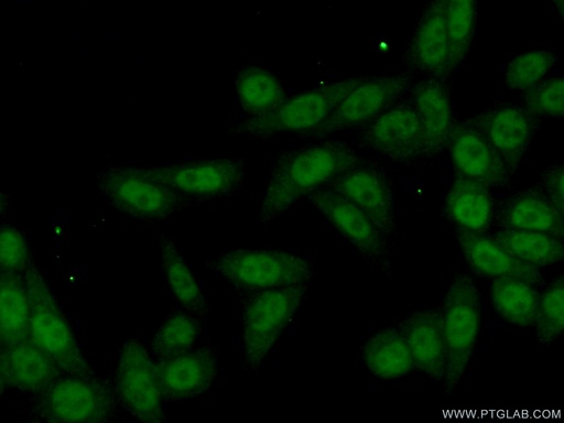 [12313-1-AP-150UL] KIN17 Polyclonal antibody