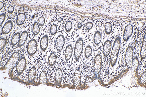 [12316-1-AP-150UL] ANGPTL2 Polyclonal antibody