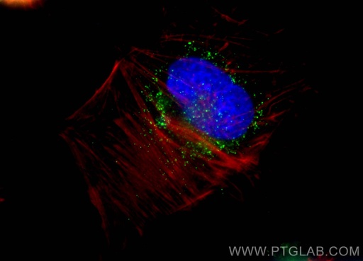 [12319-2-AP-20UL] ACAA1 Polyclonal antibody
