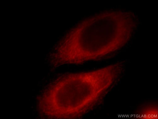 [12321-1-AP-20UL] RAB3IP/Rabin8 Polyclonal antibody