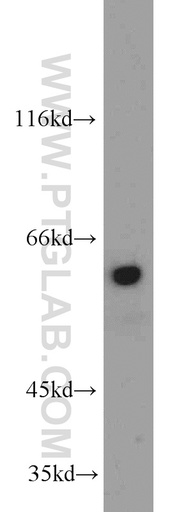 [12324-1-AP-150UL] TRIP4 Polyclonal antibody
