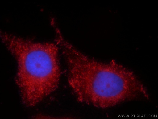 [12326-1-AP-150UL] TIMP-4 Polyclonal antibody