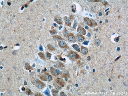 [12327-1-AP-150UL] TWSG1 Polyclonal antibody
