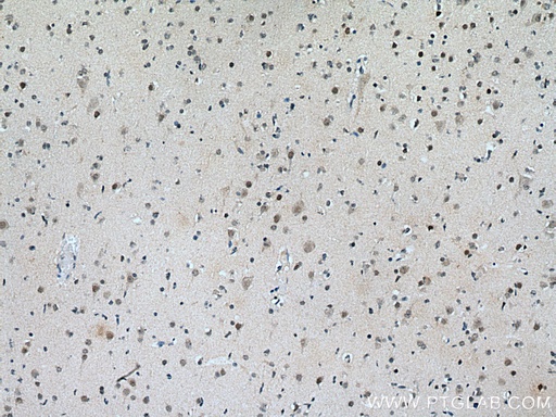 [12331-1-AP-150UL] ASH2L Polyclonal antibody