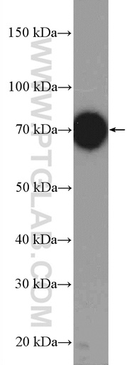 [12333-1-AP-150UL] UBE3C Polyclonal antibody