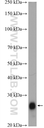 [12336-1-AP-20UL] FAM3D Polyclonal antibody