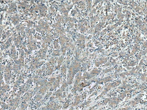 [12338-1-AP-150UL] DNAJC12 Polyclonal antibody