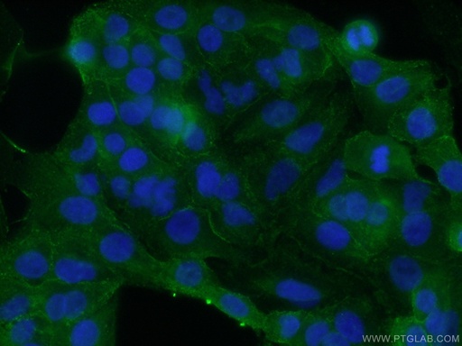 [12339-1-AP-20UL] SDPR Polyclonal antibody