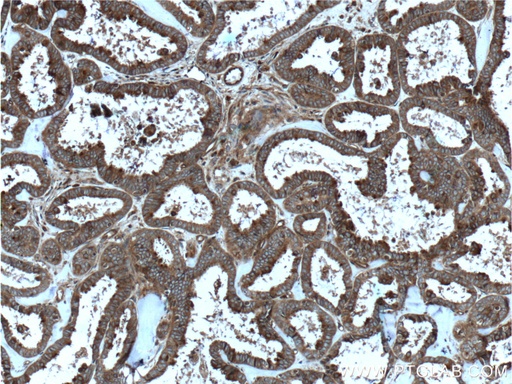 [12340-1-AP-20UL] RALB Polyclonal antibody