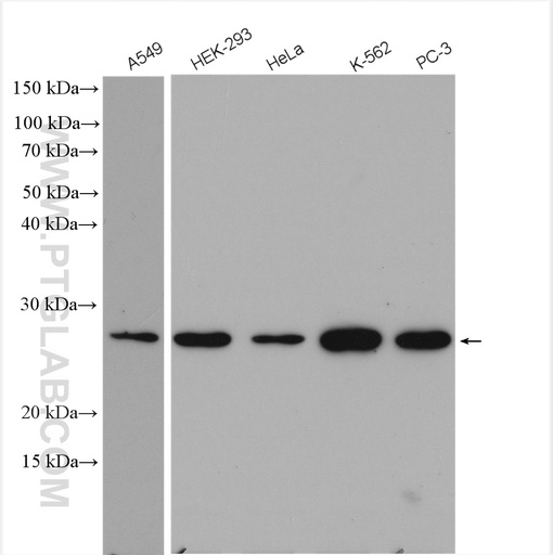 [12342-2-AP-150UL] PSMD10 Polyclonal antibody
