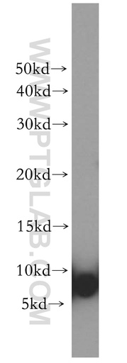 [12343-1-AP-150UL] S100A3 Polyclonal antibody