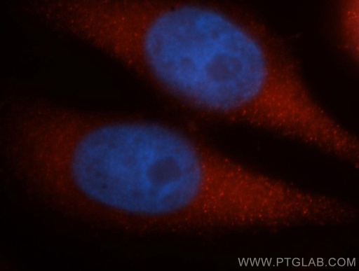 [12345-1-AP-150UL] DYNC1H1 Polyclonal antibody