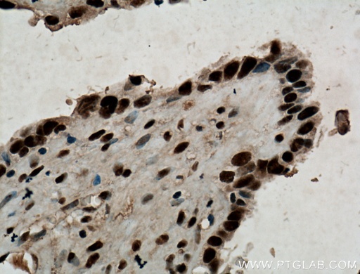 [12347-1-AP-150UL] MAGOH Polyclonal antibody
