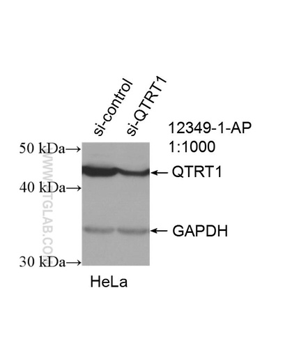 [12349-1-AP-150UL] QTRT1 Polyclonal antibody
