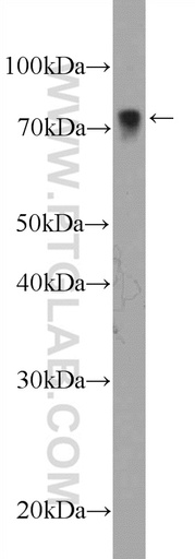 [12350-1-AP-20UL] LIMK2 Polyclonal antibody