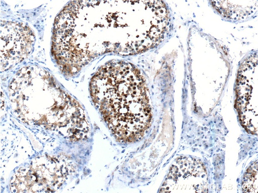 [12351-1-AP-150UL] CABYR Polyclonal antibody