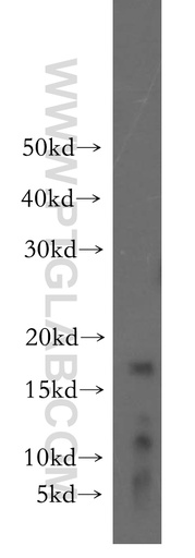 [12352-1-AP-20UL] GILZ Polyclonal antibody