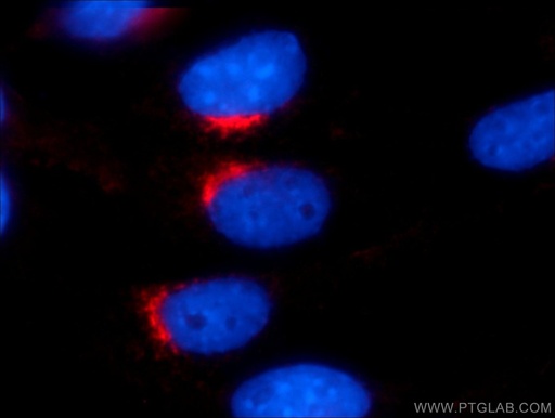 [12354-1-AP-20UL] VTI1A Polyclonal antibody