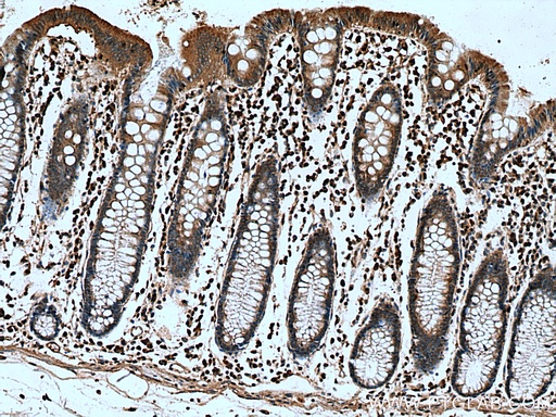 [12356-1-AP-20UL] AKAP10 Polyclonal antibody