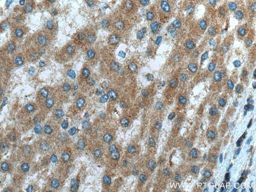 [12358-1-AP-20UL] NDUFB3 Polyclonal antibody