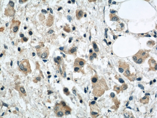 [12359-1-AP-150UL] SYTL2 Polyclonal antibody