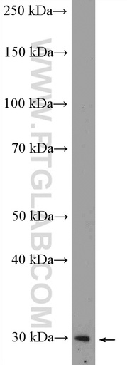 [12360-1-AP-150UL] MXI1 Polyclonal antibody