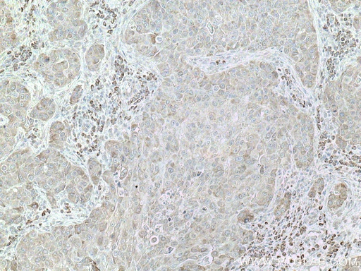 [12362-1-AP-20UL] DNAJC1 Polyclonal antibody