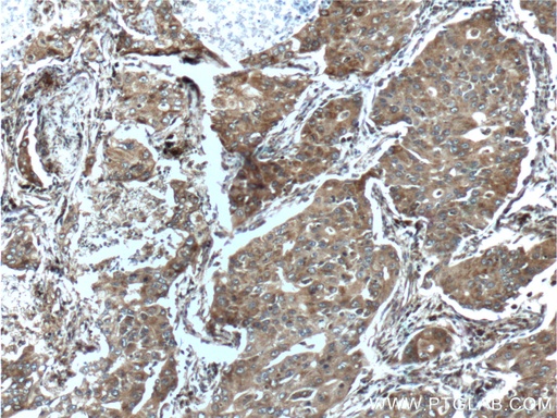 [12363-1-AP-150UL] CCNDBP1 Polyclonal antibody