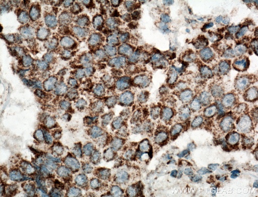 [12364-1-AP-20UL] UQCRH Polyclonal antibody
