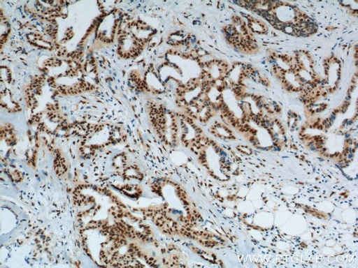 [12366-2-AP-150UL] KPNA6 Polyclonal antibody