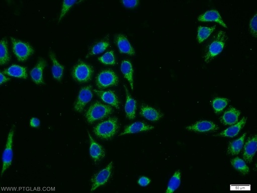 [12367-1-AP-150UL] DPH2 Polyclonal antibody
