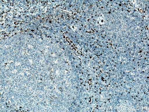 [12372-1-AP-150UL] IL-33 Polyclonal antibody