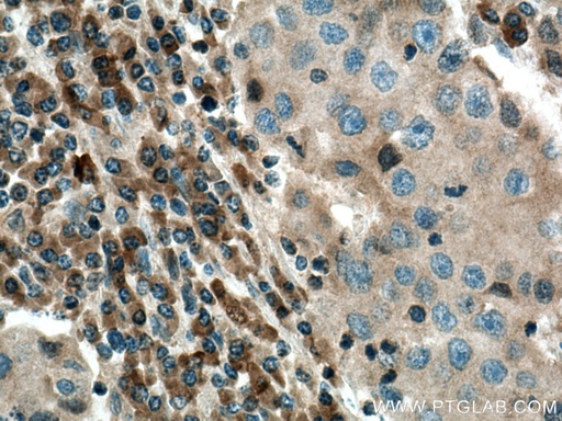 [12375-1-AP-20UL] COX2/ Cyclooxygenase 2/ PTGS2 Polyclonal antibody