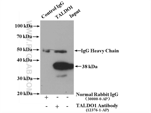 [12376-1-AP-150UL] TALDO1 Polyclonal antibody