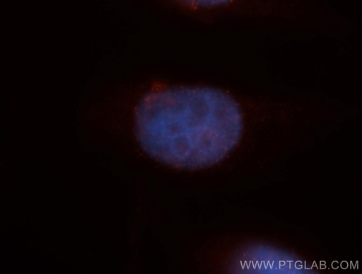 [12380-1-AP-20UL] HDGFRP3 Polyclonal antibody