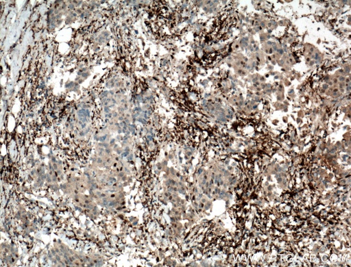 [12383-1-AP-20UL] PD-ECGF Polyclonal antibody