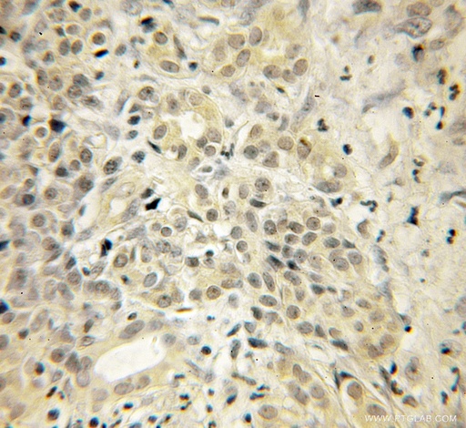 [12384-1-AP-150UL] UCHL3 Polyclonal antibody
