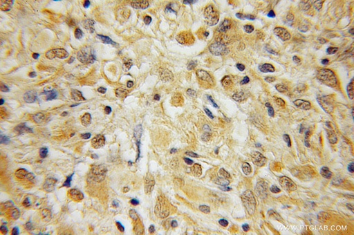 [12390-1-AP-20UL] BEX1/2 Polyclonal antibody