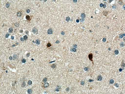[12391-1-AP-20UL] CA8 Polyclonal antibody