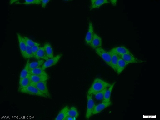 [12400-1-AP-20UL] MAGEB1 Polyclonal antibody