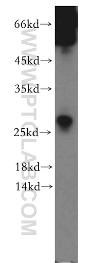 [12401-1-AP-20UL] SSX5 Polyclonal antibody