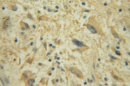 [12403-2-AP-20UL] DPM1 Polyclonal antibody