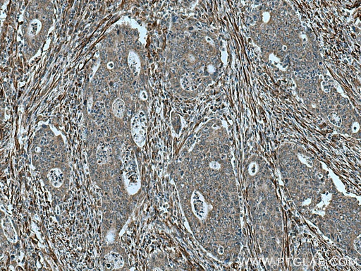 [12404-1-AP-20UL] TPST1 Polyclonal antibody