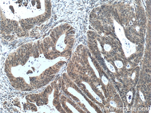[12405-1-AP-20UL] NUP133 Polyclonal antibody