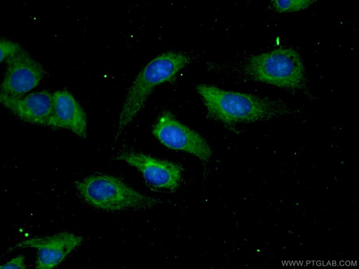 [12406-1-AP-20UL] Aconitase 1 Polyclonal antibody