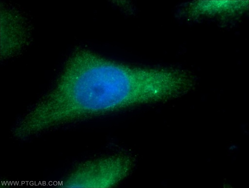 [12407-1-AP-20UL] SGCE Polyclonal antibody